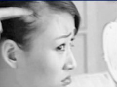 長期陽痿居然會導致嚴重脫發